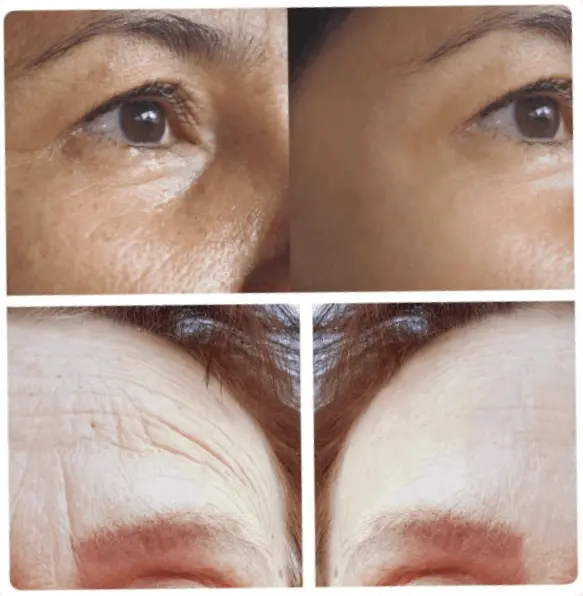 Timeless Beauty Serum 8